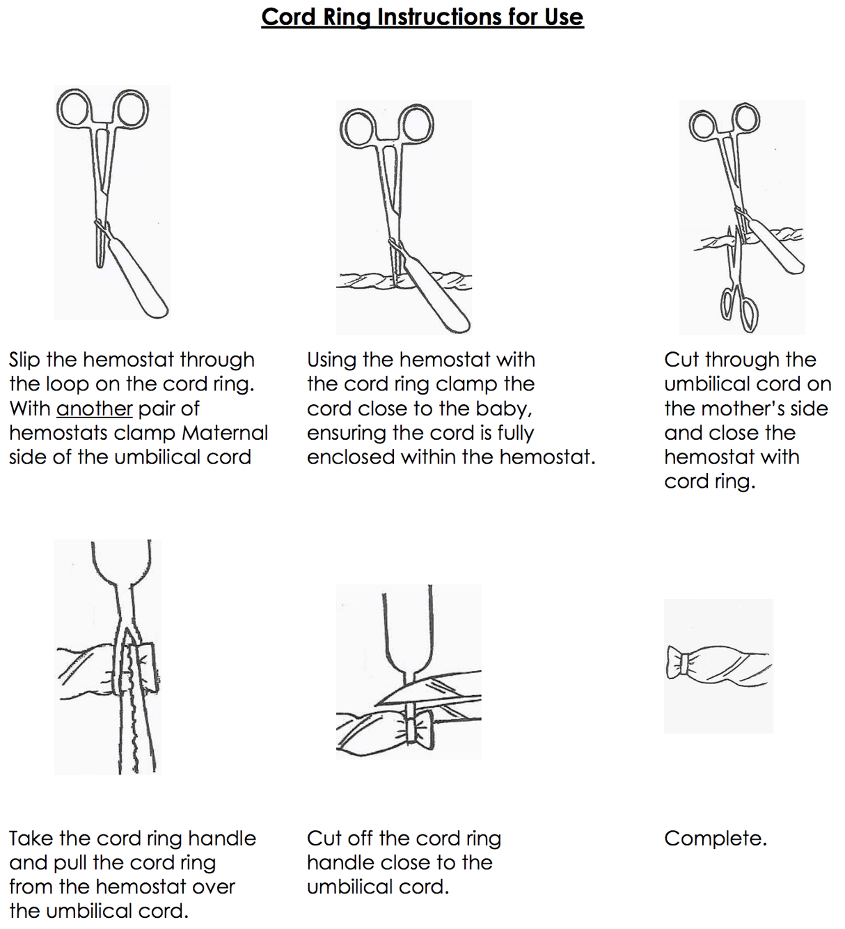CETRO Cord Rings-Umbilical Cord Needs-Birth Supplies Canada