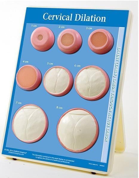 Cervical Dilation Model-Teaching Aids-Birth Supplies Canada