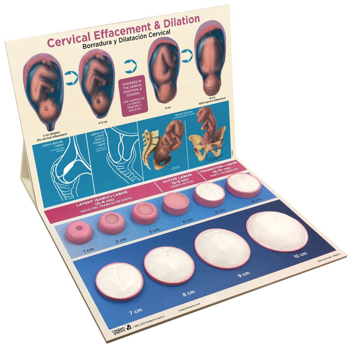 Cervical Effacement & Dilation Model-Teaching Aids-Birth Supplies Canada