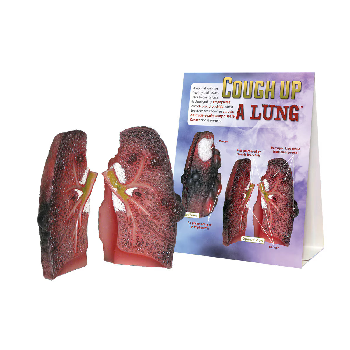 Cough Up A Lung Model-Teaching Aids-Birth Supplies Canada