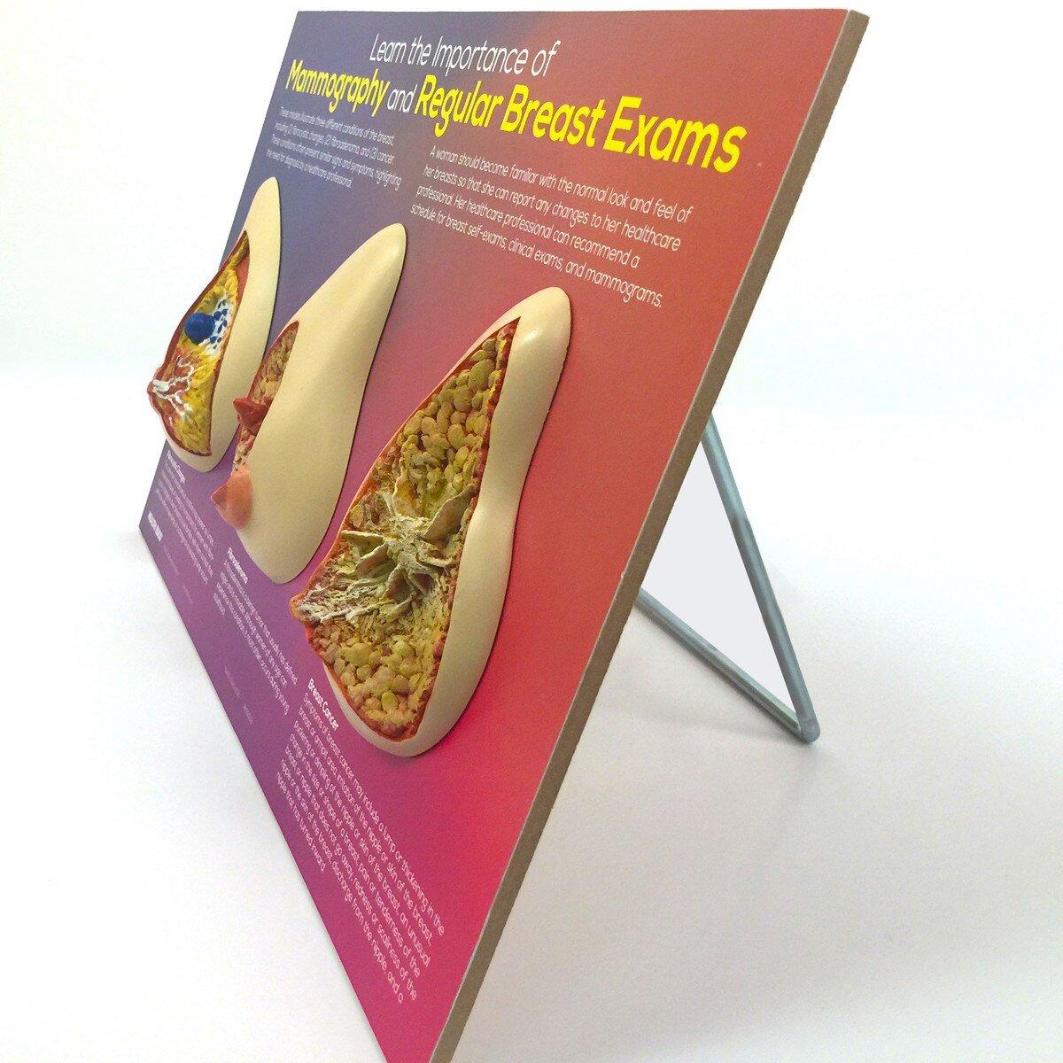 Mammography & Breast Exam Importance Display | 3-D Models-Teaching Aids-Birth Supplies Canada