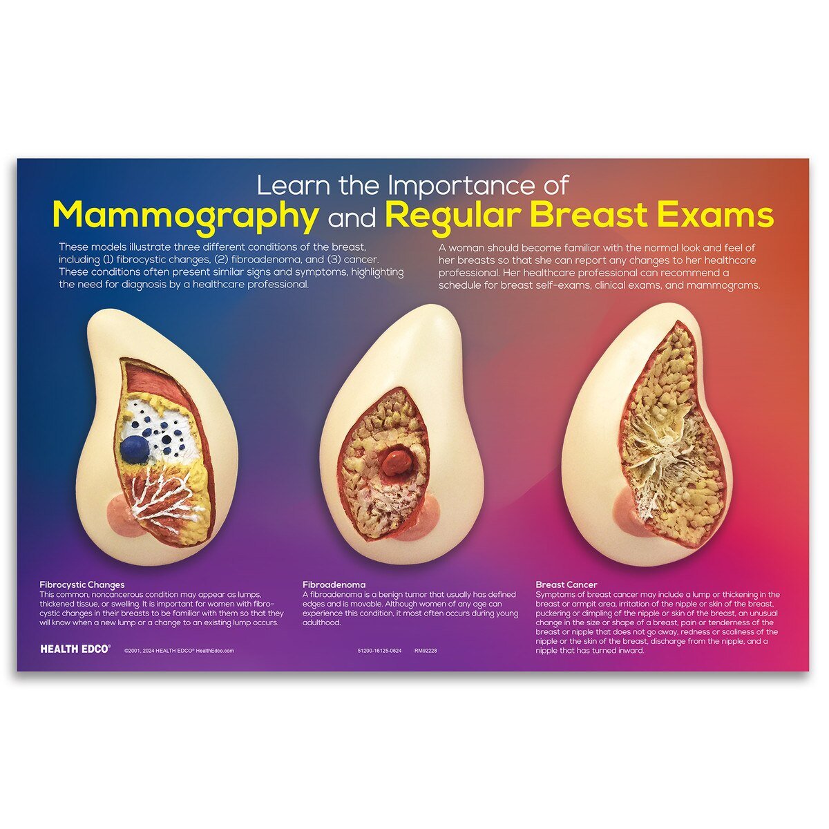 Mammography & Breast Exam Importance Display | 3-D Models-Teaching Aids-Birth Supplies Canada