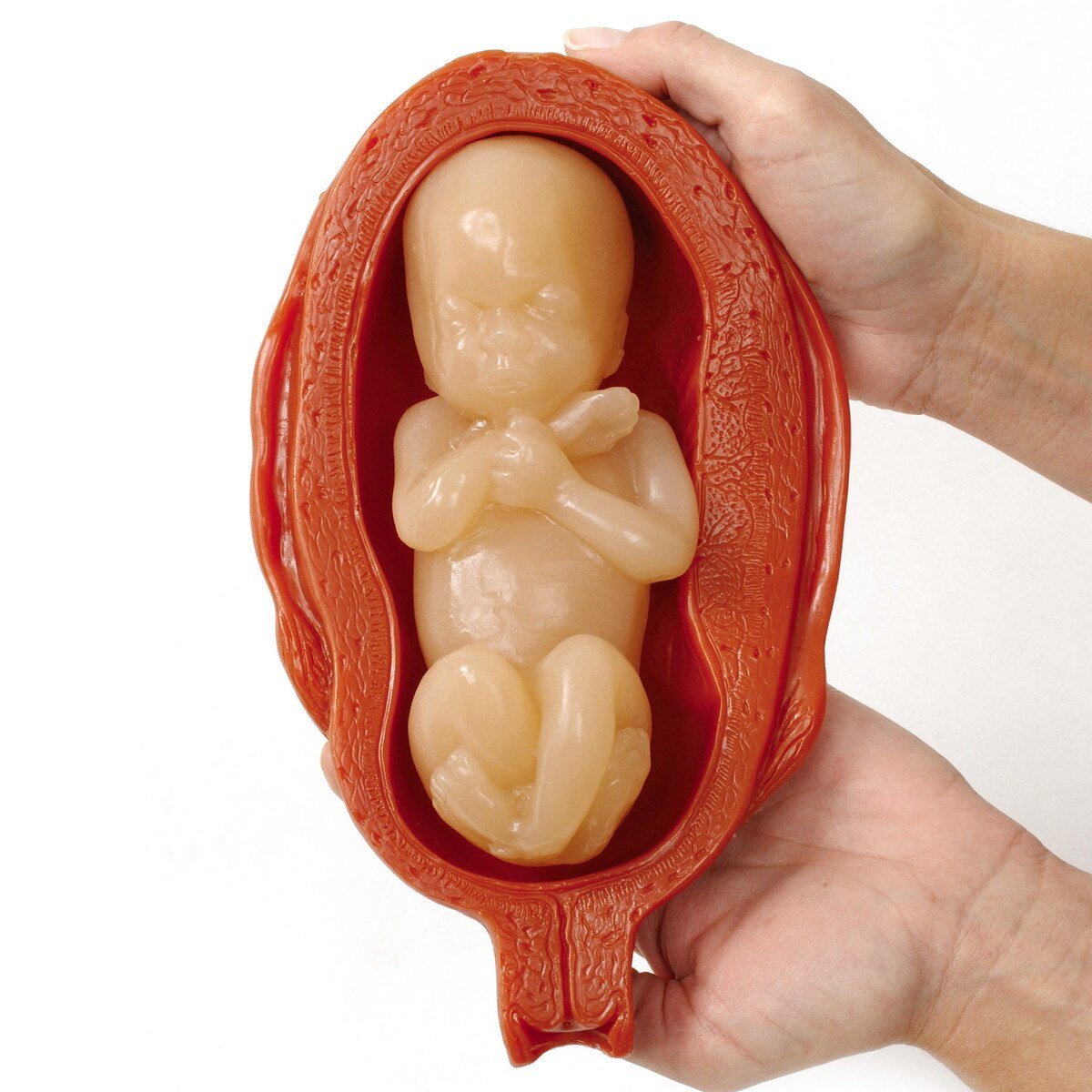 Uterus/Fetus Model Set (5) – BIOLIKE 2™ Teaching Models-Teaching Aids-Birth Supplies Canada