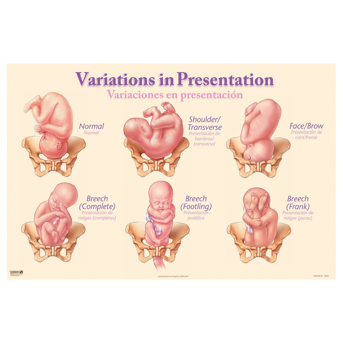 Variations in Presentation Chart – Laminated Bilingual-Teaching Aids-Birth Supplies Canada