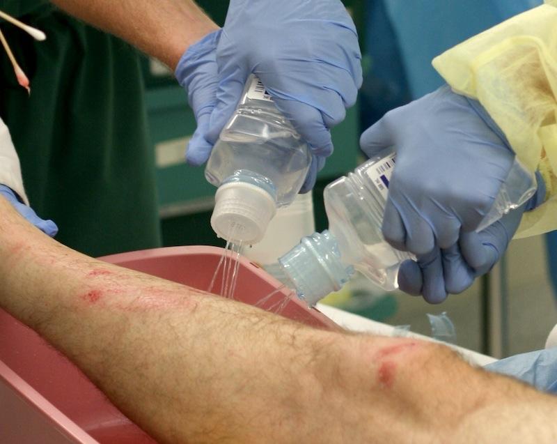 Irrigation Solutions - Birth Supplies Canada