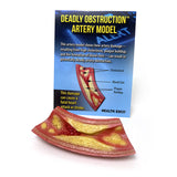 Deadly Obstruction Artery Model – Heart Health Display