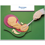 Labour & Birth Intervention Chart Set – Bilingual English/Spanish