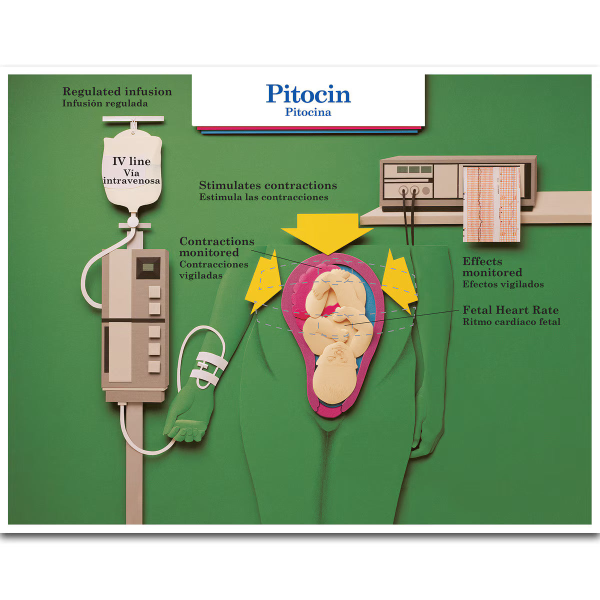 Labour & Birth Intervention Chart Set – Bilingual English/Spanish