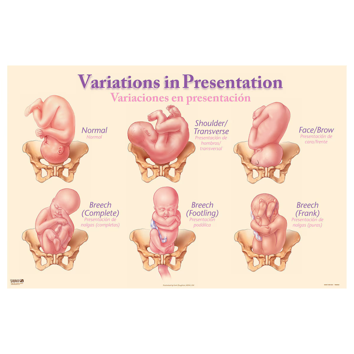 Variations in Presentation Chart
