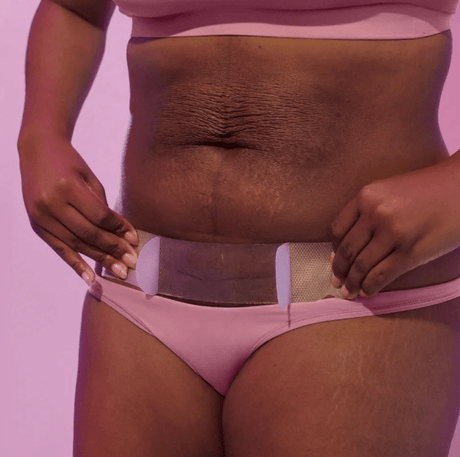 C-Section Silicone Scar Patches | FridaMom-C-Section Supplies-Birth Supplies Canada