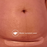 C-Section Silicone Scar Patches | FridaMom-C-Section Supplies-Birth Supplies Canada