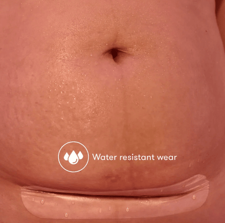 C-Section Silicone Scar Patches | FridaMom-C-Section Supplies-Birth Supplies Canada