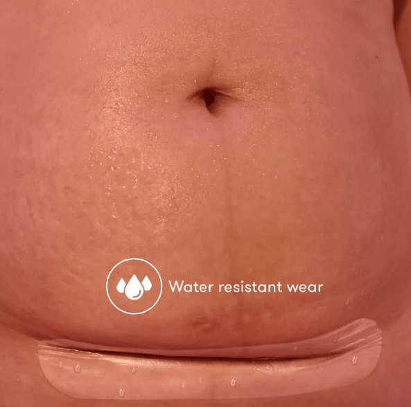 C-Section Silicone Scar Patches | FridaMom-Medical Supplies-Birth Supplies Canada
