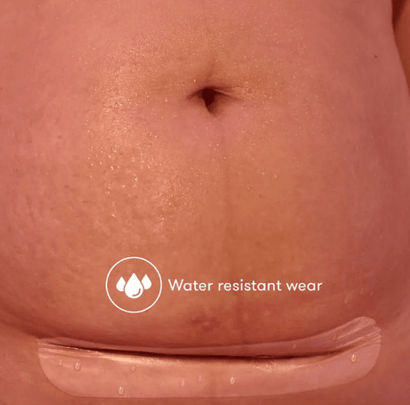 C-Section Silicone Scar Patches | FridaMom-Medical Supplies-Birth Supplies Canada