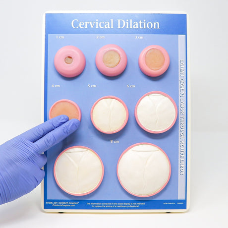 Cervical Chart Midwifery Teaching Aids and Clinical Education Models – Birth Supplies ...