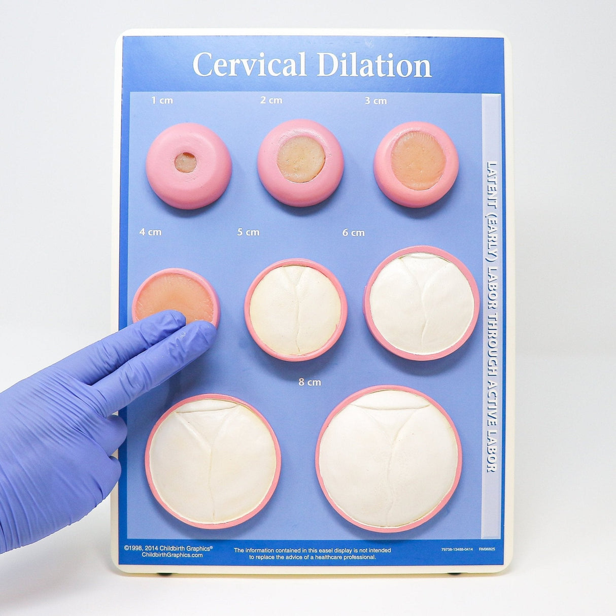 Cervical Dilation Model | Stages of Labor Visual Aid-Teaching Aids-Birth Supplies Canada