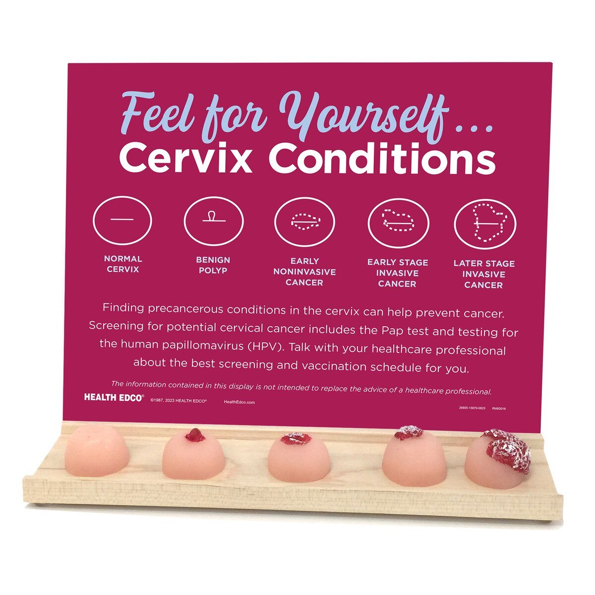 Cervix Conditions Palpation Model Display for Patient Education-Teaching Aids-Birth Supplies Canada