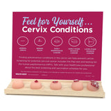 Cervix Conditions Palpation Model Display for Patient Education-Teaching Aids-Birth Supplies Canada