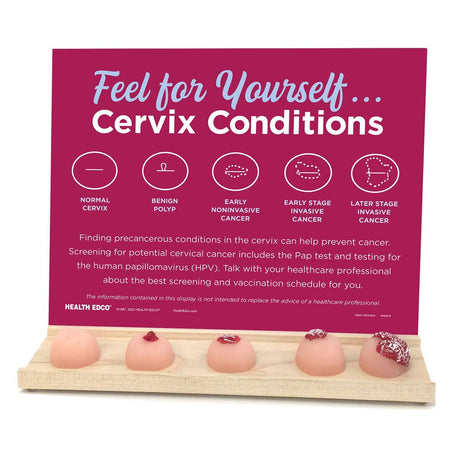 Cervix Conditions Palpation Model Display for Patient Education-Teaching Aids-Birth Supplies Canada