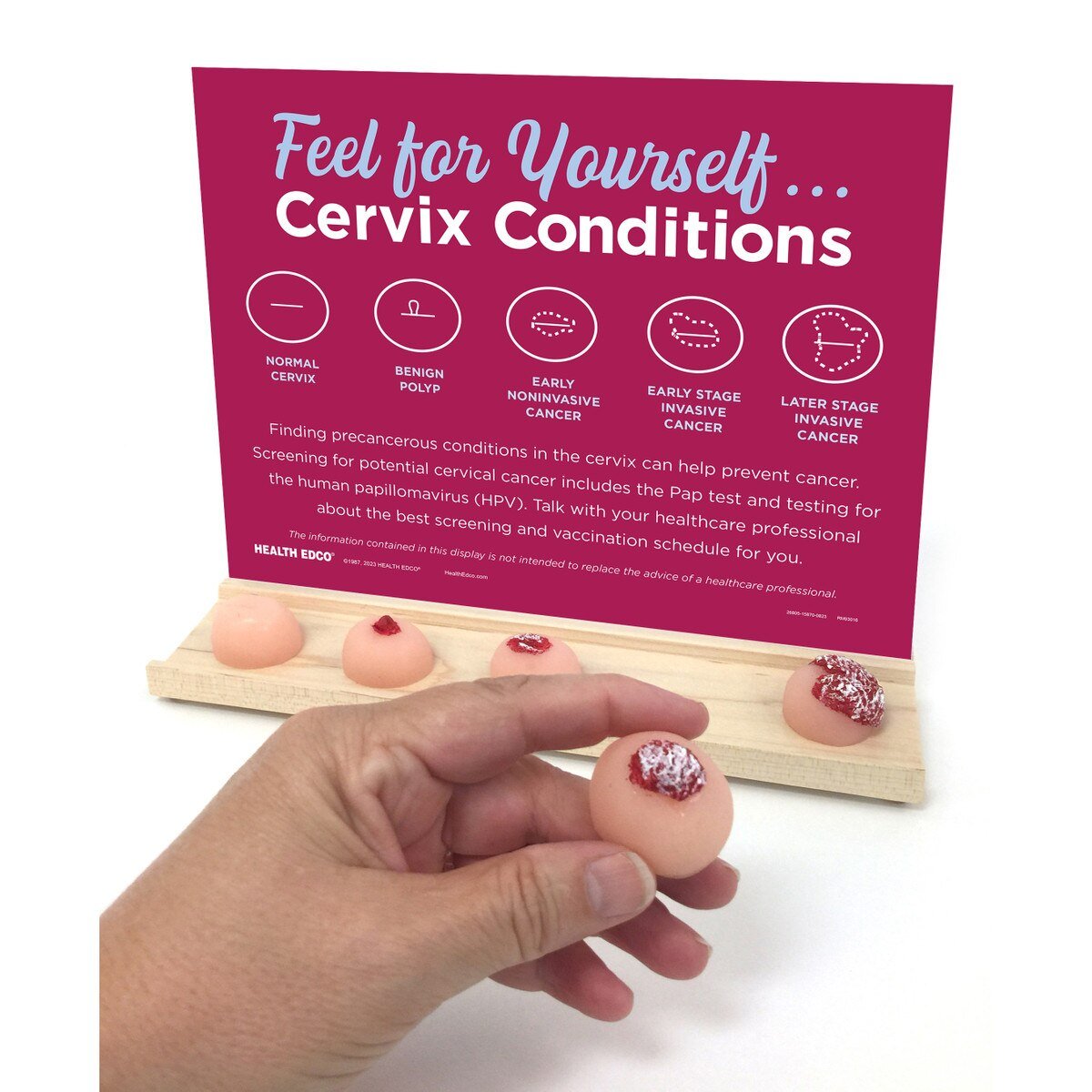 Cervix Conditions Palpation Model Display for Patient Education-Teaching Aids-Birth Supplies Canada