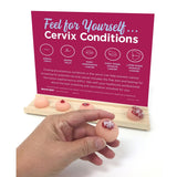 Cervix Conditions Palpation Model Display for Patient Education-Teaching Aids-Birth Supplies Canada