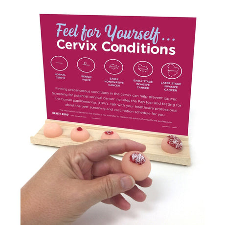 Cervix Conditions Palpation Model Display for Patient Education-Teaching Aids-Birth Supplies Canada