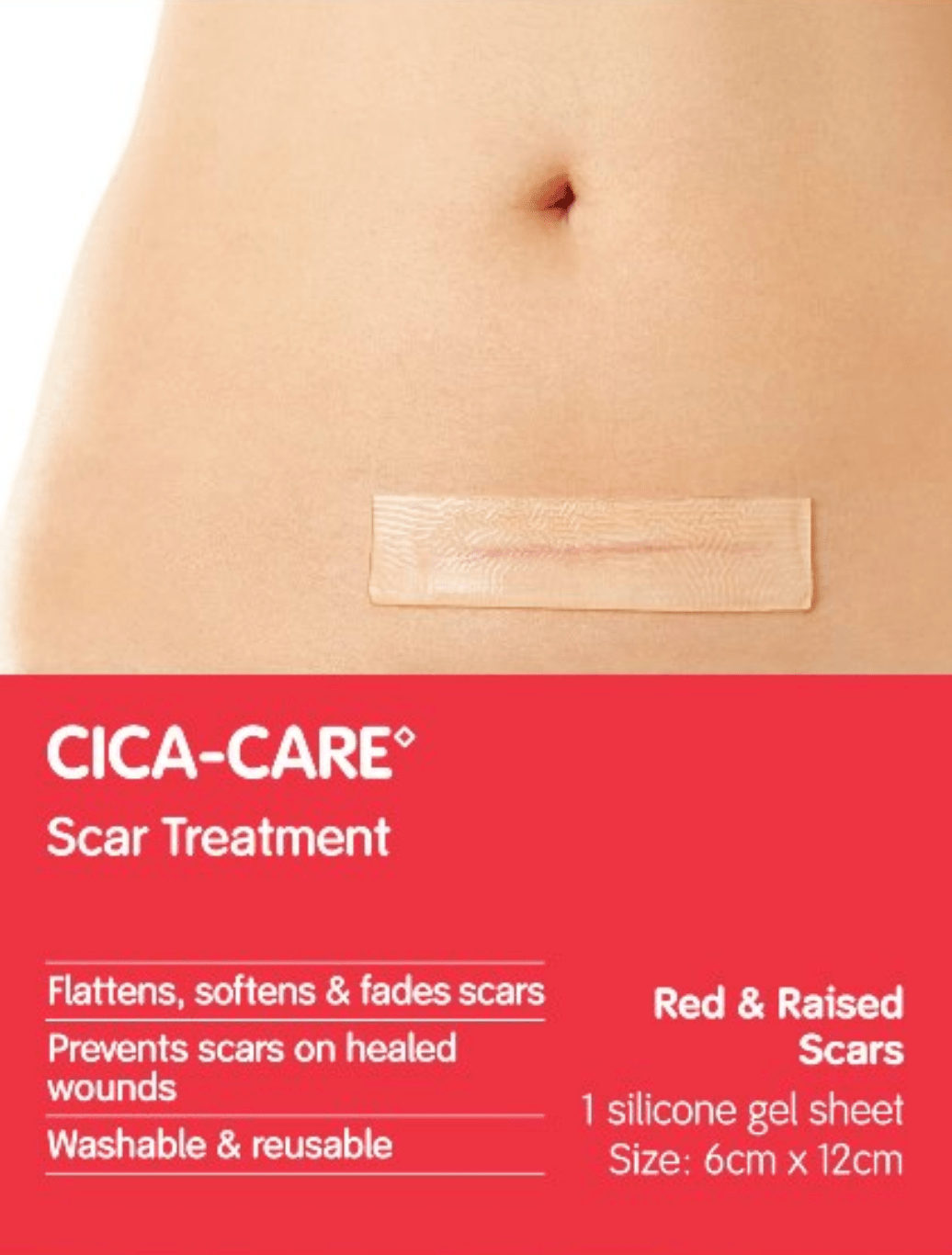 Cica-care Scar Treatment ~ for post cesarean