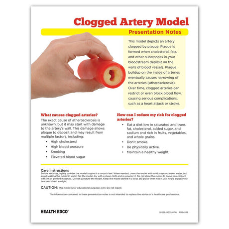 Clogged Artery Model with Plaque Buildup for Heart Health Education-Teaching Aids-Birth Supplies Canada