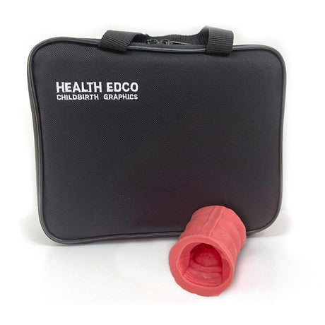 Colorectal Polyp Model-Teaching Aids-Birth Supplies Canada