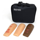 Deluxe TB Test Reading and Induration Palpation Arm Set (3 Models)-Teaching Aids-Birth Supplies Canada