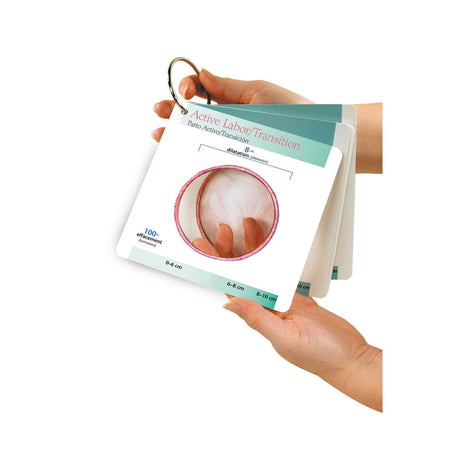 Labor Progress Pocket Guide-Teaching Aids-Birth Supplies Canada