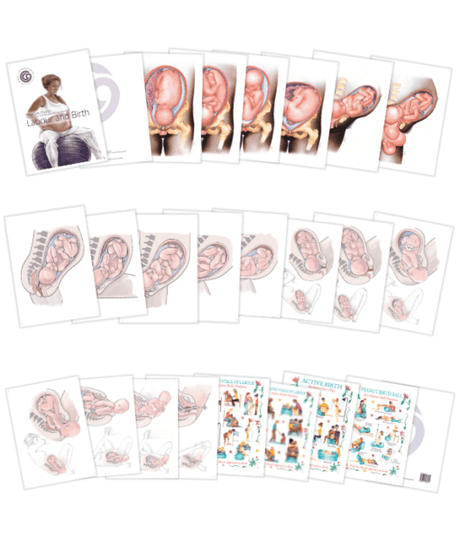 Labour & Birth Charts – Desk Set Series-Teaching Aids-Birth Supplies Canada