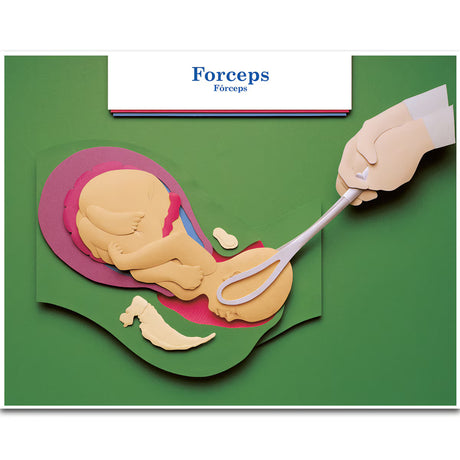 Labour & Birth Intervention Chart Set – Bilingual English/Spanish-Teaching Aids-Birth Supplies Canada