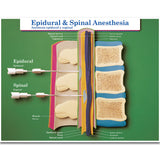 Labour & Birth Intervention Chart Set – Bilingual English/Spanish-Teaching Aids-Birth Supplies Canada