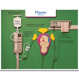 Labour & Birth Intervention Chart Set – Bilingual English/Spanish-Teaching Aids-Birth Supplies Canada