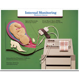 Labour & Birth Intervention Chart Set – Bilingual English/Spanish-Teaching Aids-Birth Supplies Canada
