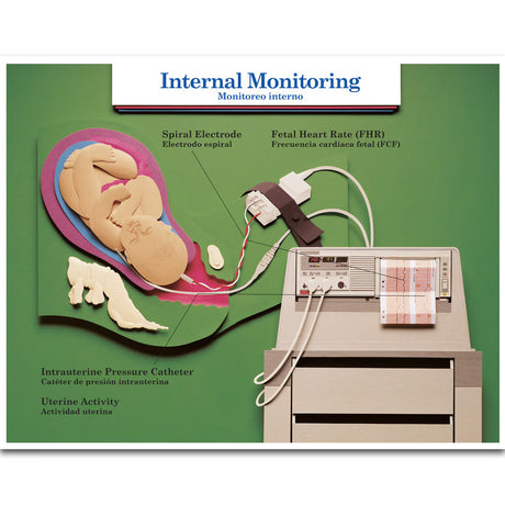 Labour & Birth Intervention Chart Set – Bilingual English/Spanish-Teaching Aids-Birth Supplies Canada