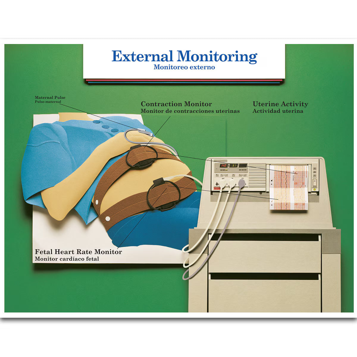 Labour & Birth Intervention Chart Set – Bilingual English/Spanish-Teaching Aids-Birth Supplies Canada
