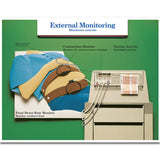 Labour & Birth Intervention Chart Set – Bilingual English/Spanish-Teaching Aids-Birth Supplies Canada