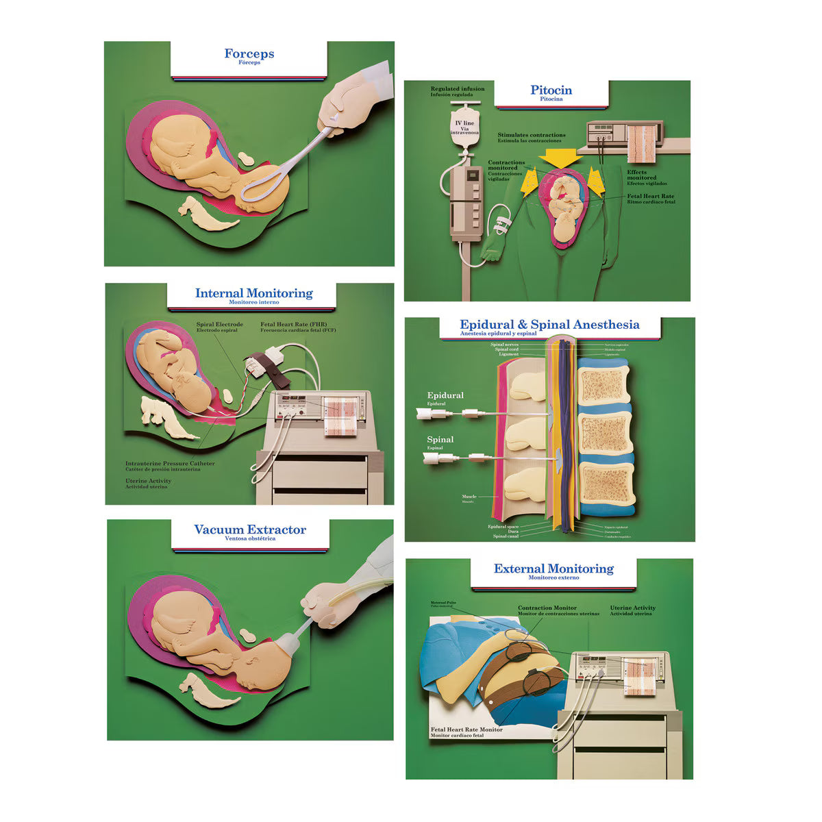 Labour & Birth Intervention Chart Set – Bilingual English/Spanish-Teaching Aids-Birth Supplies Canada
