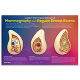Mammography & Breast Exam Importance Display | 3-D Models-Teaching Aids-Birth Supplies Canada