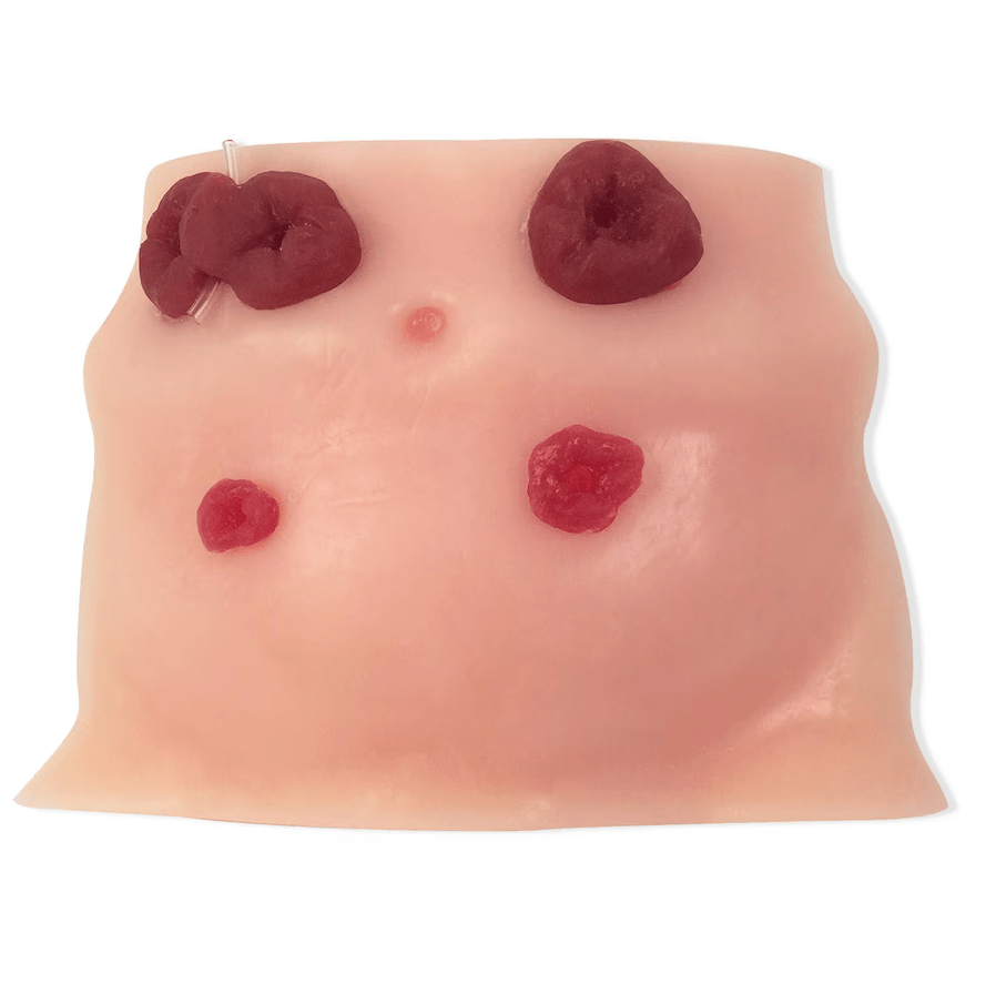 Ostomy Care Model, Beige-Teaching Aids-Birth Supplies Canada