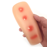 Palpable TB Testing Arm Set-Teaching Aids-Birth Supplies Canada