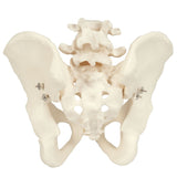 Pelvis Model with Adjustable Screws-Teaching Aids-Birth Supplies Canada