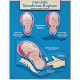 Six Essential Labor and Birth Charts (6), English/Spanish-Teaching Aids-Birth Supplies Canada