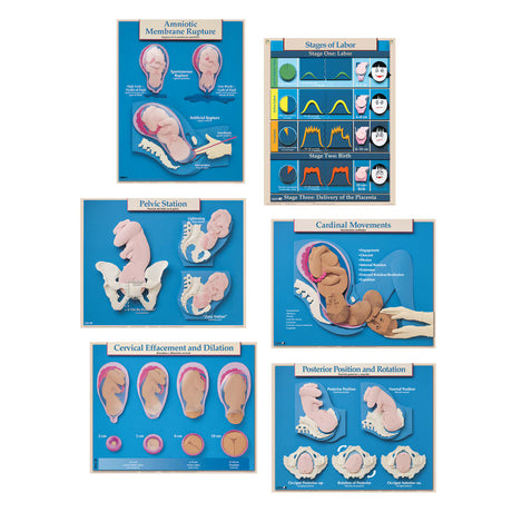 Six Essential Labor and Birth Charts (6), English/Spanish-Teaching Aids-Birth Supplies Canada