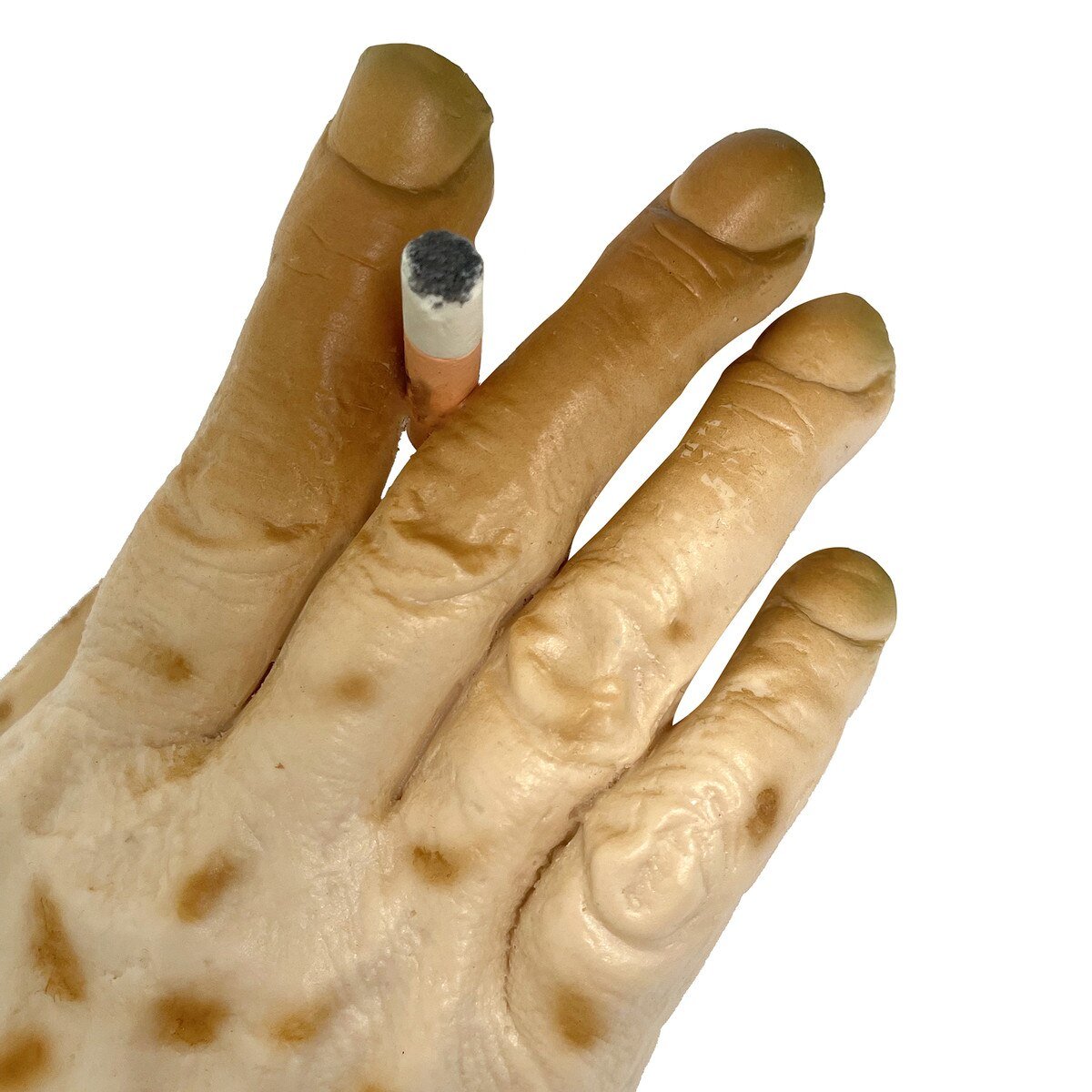 Smoker’s Hand: Smoking Awareness Hand Model – BIOLIKE™-Teaching Aids-Birth Supplies Canada