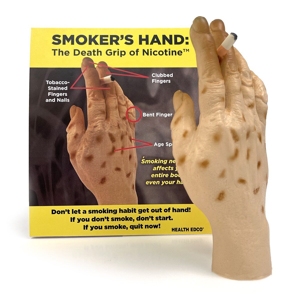 Smoker’s Hand: Smoking Awareness Hand Model – BIOLIKE™-Teaching Aids-Birth Supplies Canada
