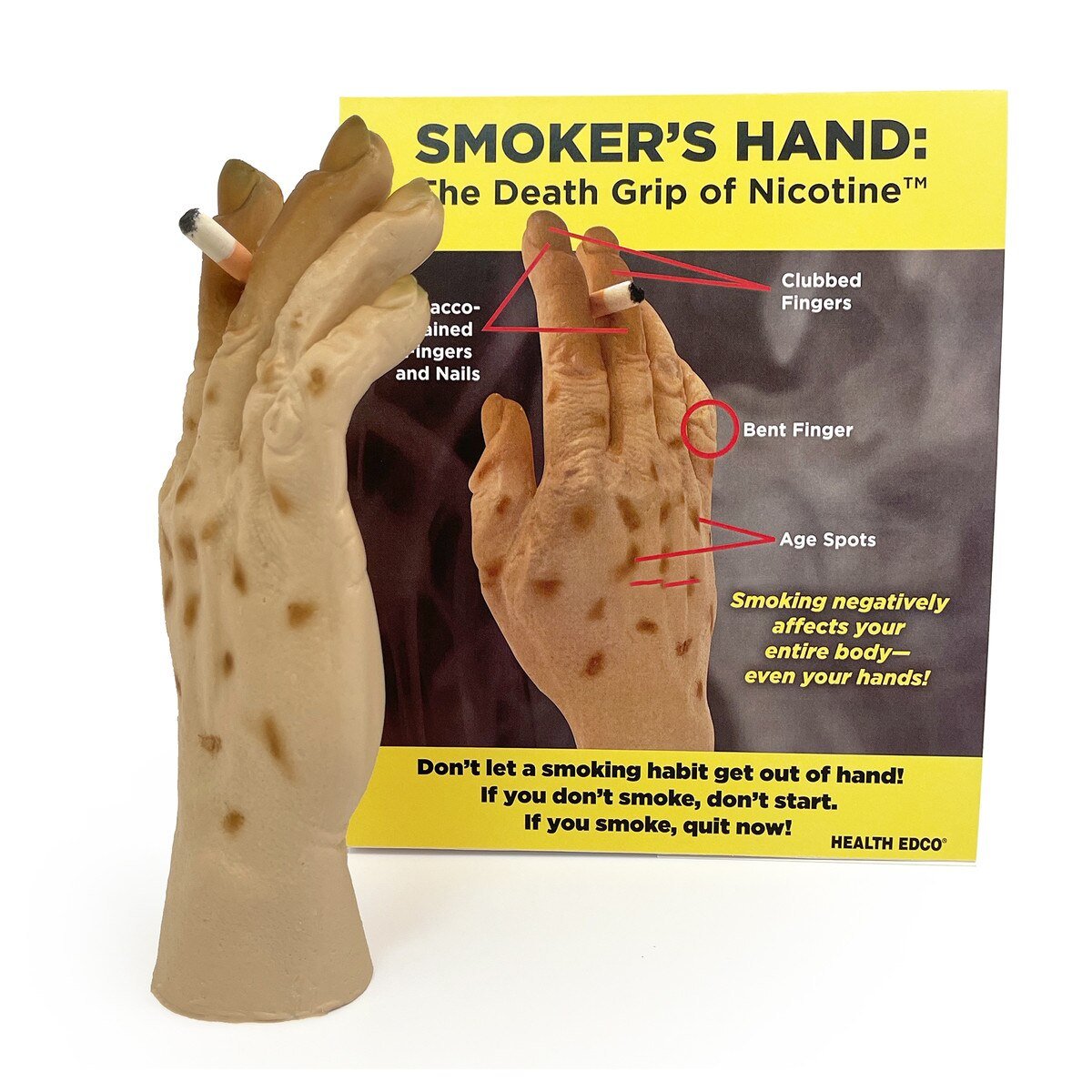 Smoker’s Hand: Smoking Awareness Hand Model – BIOLIKE™-Teaching Aids-Birth Supplies Canada