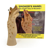 Smoker’s Hand: Smoking Awareness Hand Model – BIOLIKE™-Teaching Aids-Birth Supplies Canada